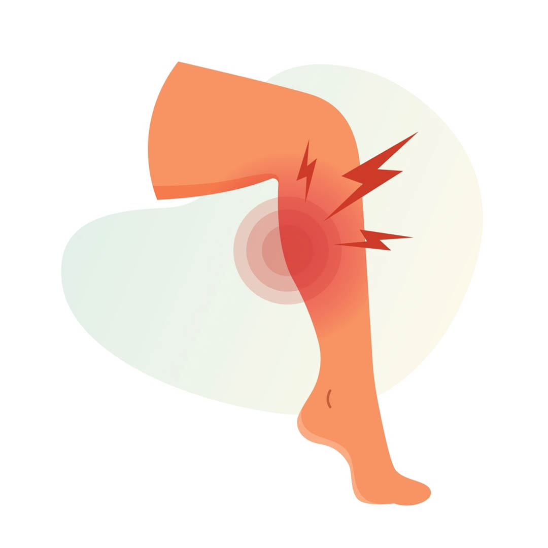 Chuột rút khi leo núi - Nguyên nhân và giải pháp